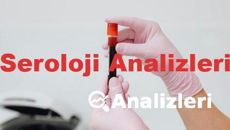 Seroloji Analizleri