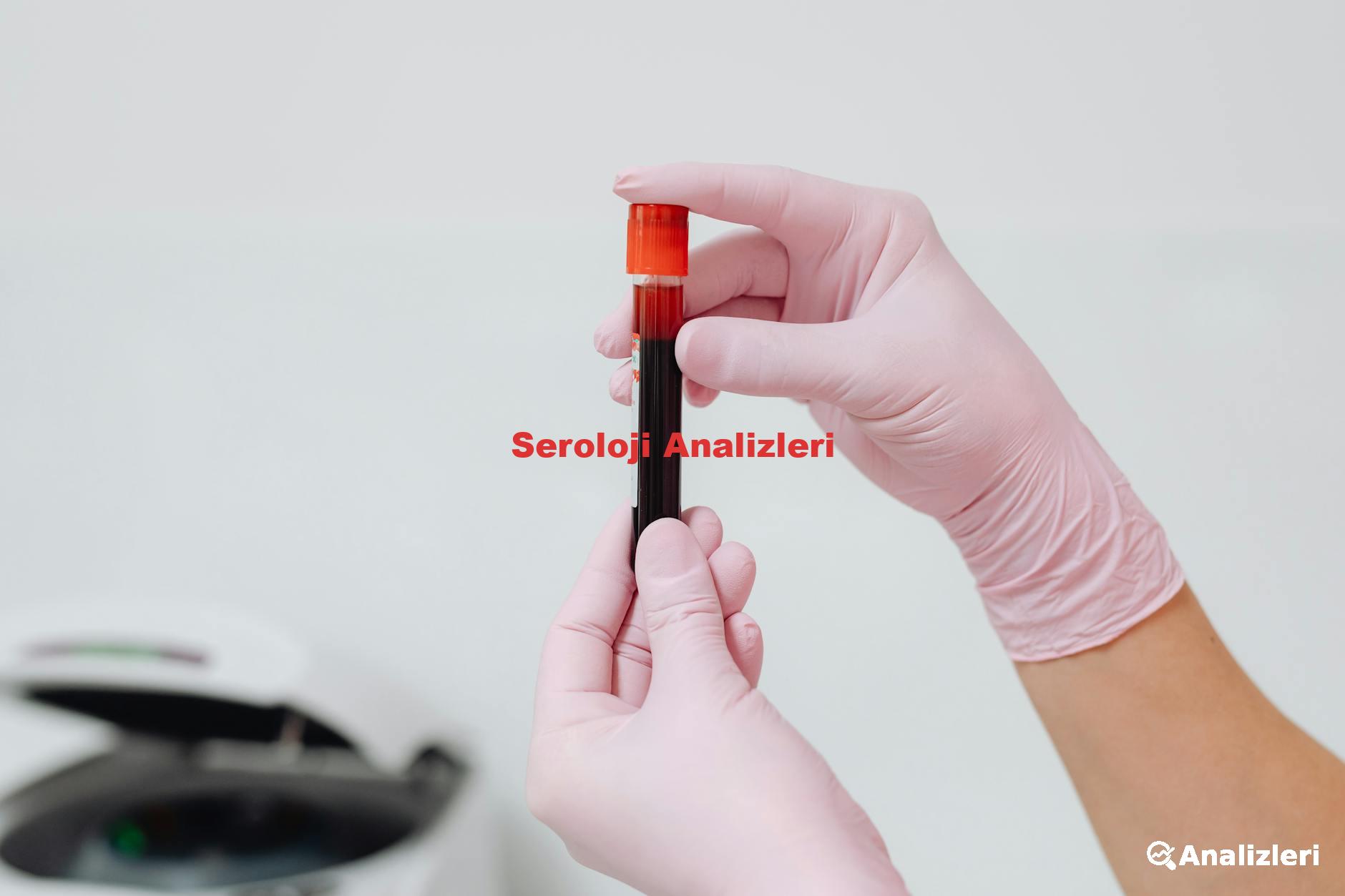 Seroloji Analizleri